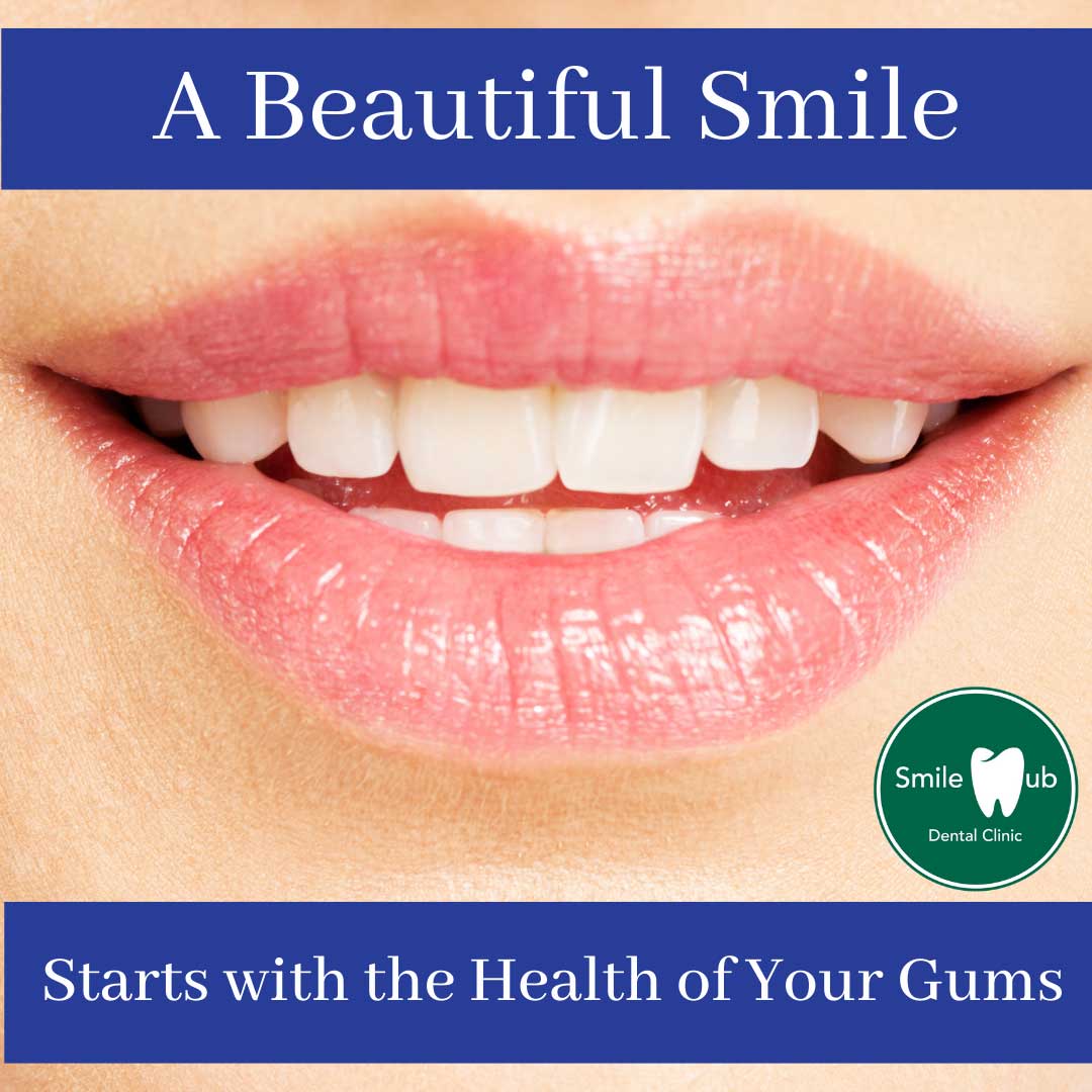 SH-12570-Gums-FB-#3