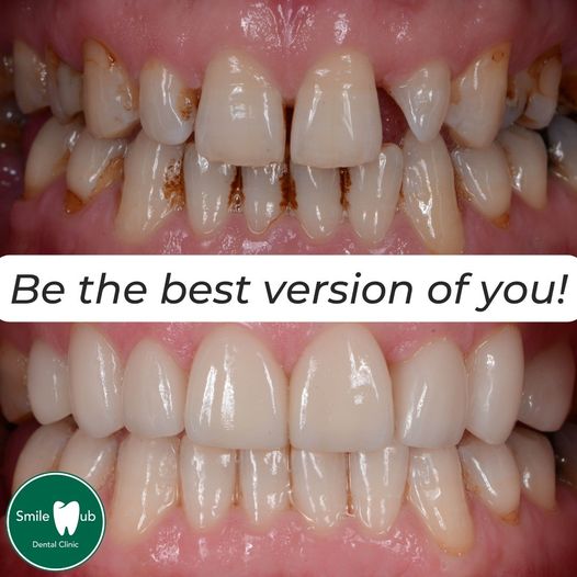 smile_ad_oct_three